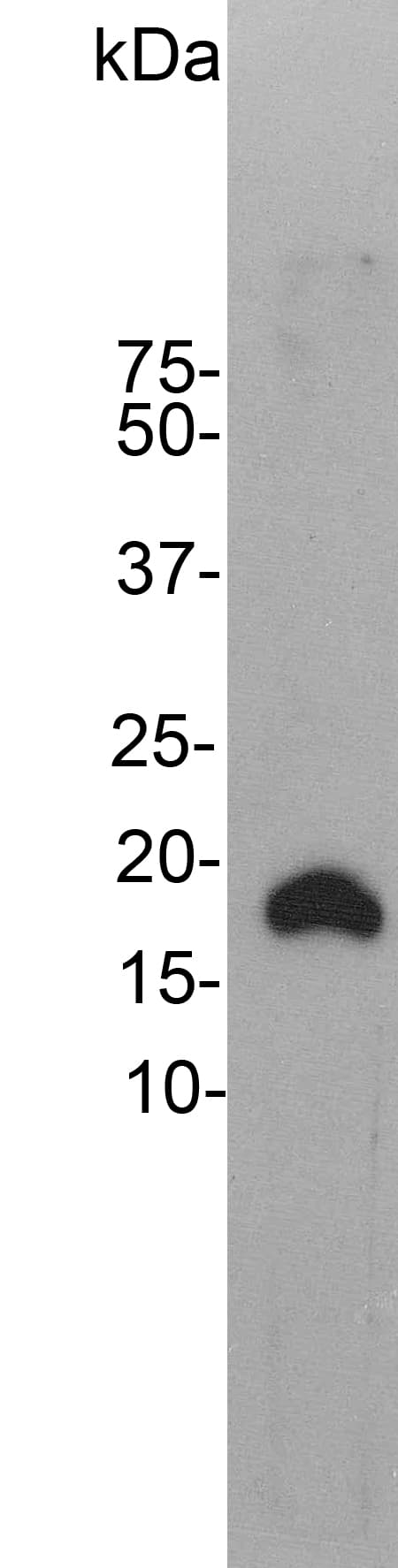 IHC-plus™ VILIP / VSNL1 Antibody