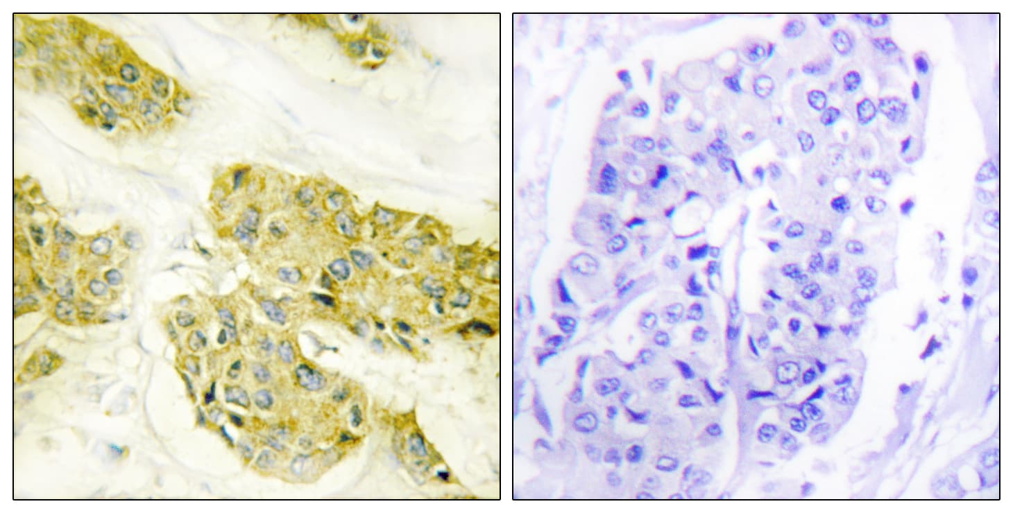 Polyclonal Rabbit anti-Human COL5A3 / Collagen V Alpha 3 Antibody (aa221-270, IHC, IF)