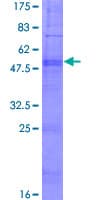 Human PDCD2L Protein (Recombinant GST)
