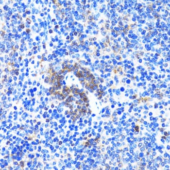 Polyclonal Rabbit anti-Human ACTR2 / ARP2 Antibody (IHC, IF, WB)