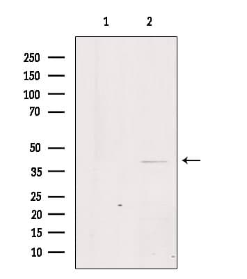 GPR21 Antibody