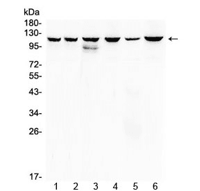 Polyclonal Rabbit anti-Human PIK3CB / PI3K Beta Antibody (IHC, WB)