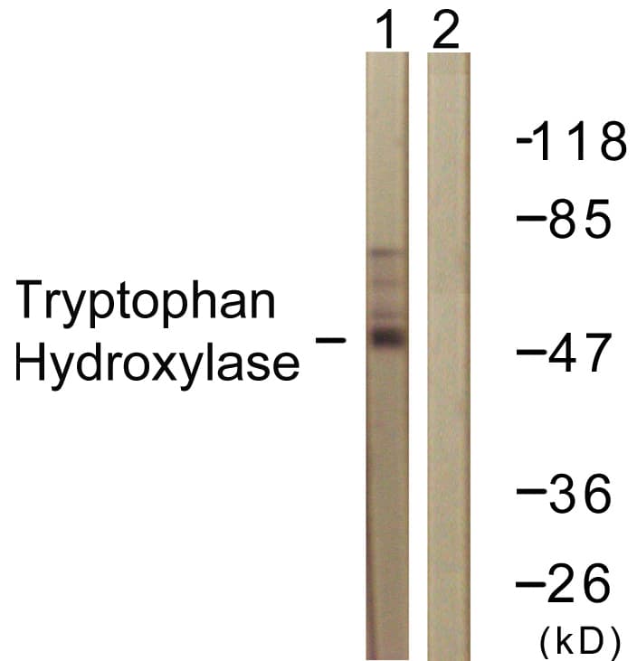 TPH1 / Tryptophan Hydroxylase Antibody (aa231-280)
