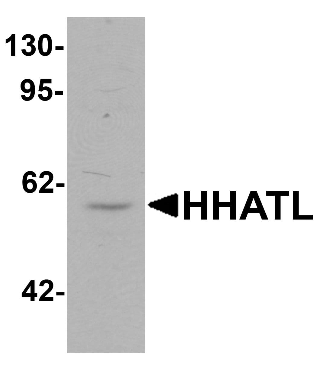 Polyclonal Rabbit anti-Human HHATL Antibody (IHC, IF, WB)
