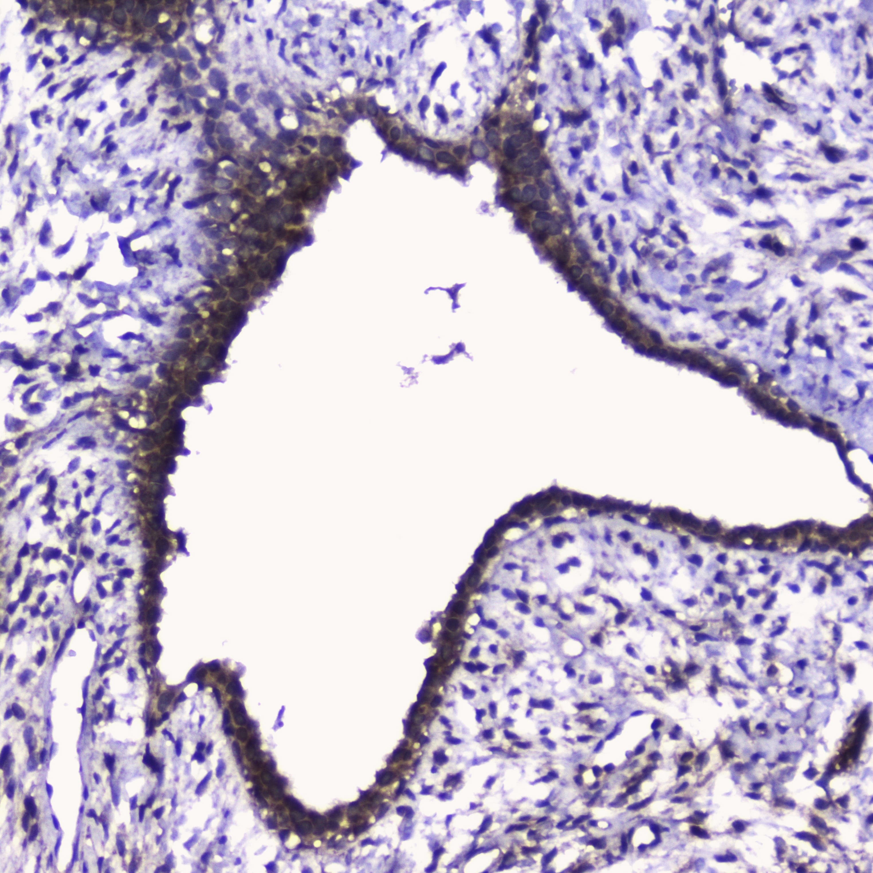 CDK6 Antibody