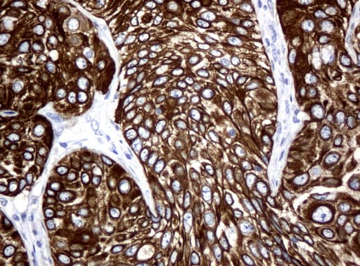 KRT18 / CK18 / Cytokeratin 18 Antibody (aa69-372, clone UMAB50)