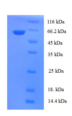 Human TBCEL / E-Like Protein (Recombinant His-SUMO)