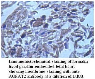 Polyclonal Rabbit anti-Human AGPAT2 Antibody (aa142-279, IHC)