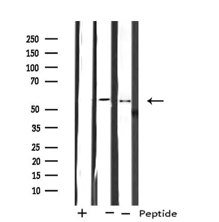 Polyclonal Rabbit anti-Human CYP2A7 Antibody (IHC, WB)