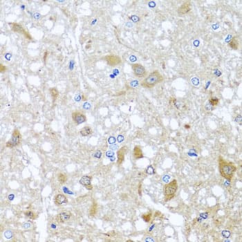Polyclonal Rabbit anti-Human EFHC1 Antibody (IHC, WB)