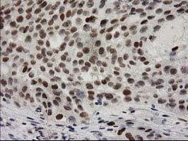 PRKCE / PKC-Epsilon Antibody (clone OTI2A12)