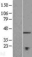 TMEM194A Protein (Over-Expression Lysate Myc-DDK (Flag))