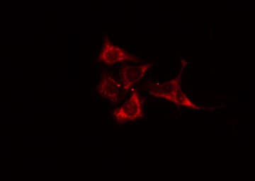 ALDOB Antibody