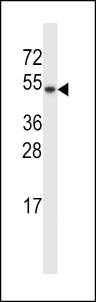 Polyclonal Rabbit anti-Human Disulfide Isomerase / TXNDC15 Antibody (aa257-285, IHC, WB)