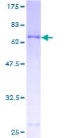 Human PDK2 Protein (Recombinant GST)