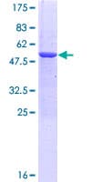 Human MED29 / IXL Protein (Recombinant GST)