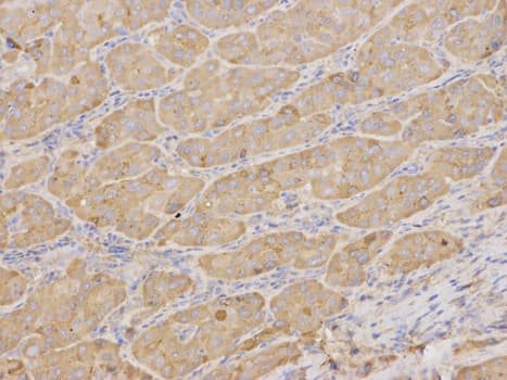 IHC-plus™ Polyclonal Rabbit anti-Human AMBP Antibody (IHC, WB)