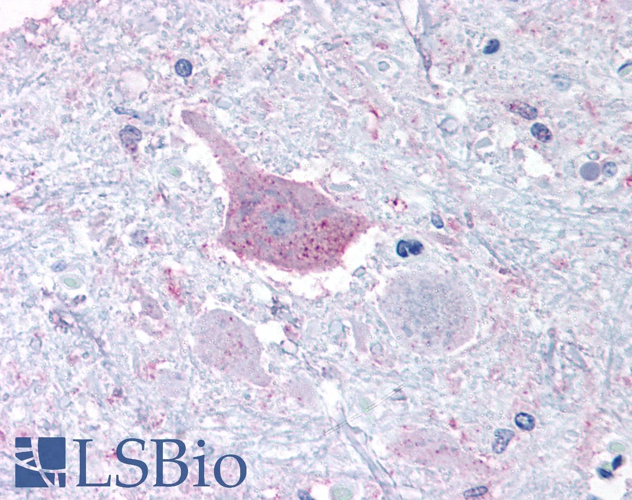 IHC-plus™ MRGD / MRGPRD Antibody (Cytoplasmic Domain)