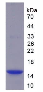 Human CST4 / Cystatin S Protein (Recombinant His)