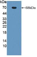 IL23R Antibody (aa25-355, HRP)