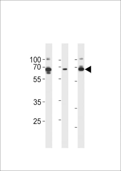 PRKAG3 / AMPK Gamma 3 Antibody (aa426-454)