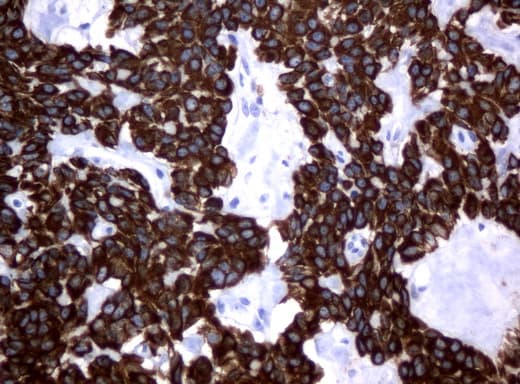 Monoclonal Mouse anti-Human KRT18 / CK18 / Cytokeratin 18 Antibody (clone UMAB50, Carrier-free, aa69-372, IHC, IF, WB)