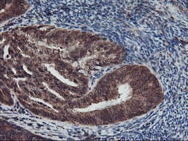 AGPAT5 Antibody (clone OTI1H10, Carrier-free)