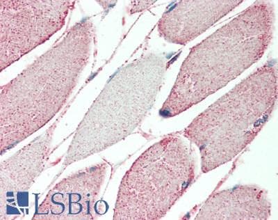 TMEM16B / ANO2 Antibody