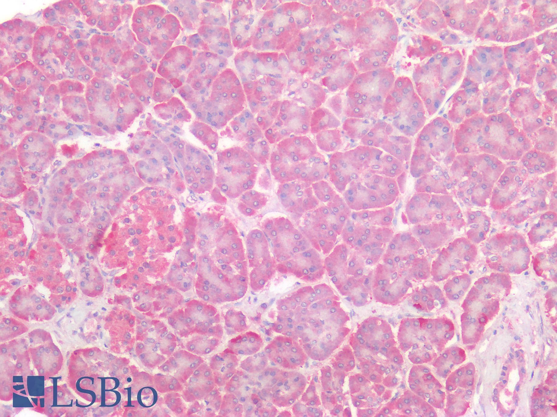 IHC-plus™ Polyclonal Rabbit anti-Human Osteonectin / SPARC Antibody (IHC)