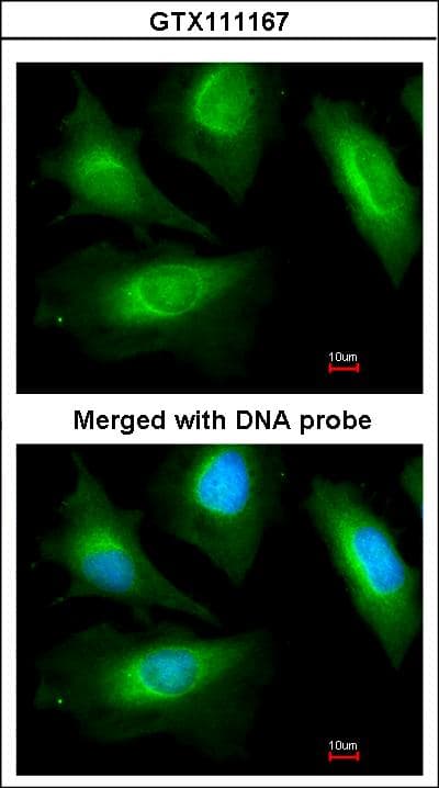 IHC-plus™ ACTN2 Antibody