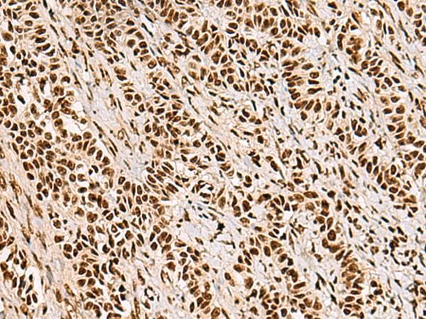 FOXI1 Antibody