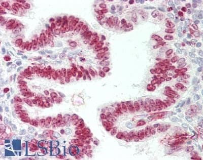 IHC-plus™ FANCA Antibody (N-Terminal)