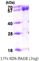 Human ACADVL Protein (Recombinant His)