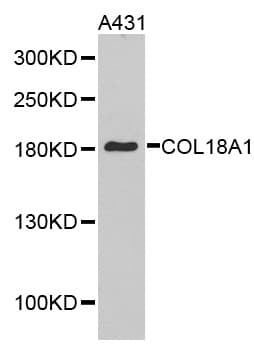 Endostatin Antibody