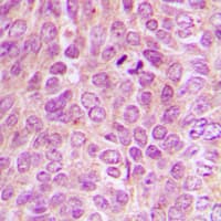 Polyclonal Rabbit anti-Human Protein Kinase A (PKA) Catalytic Subunit Antibody (phospho-Thr198, IHC, IF, WB)
