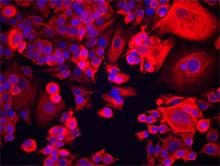 IHC-plus™ Monoclonal Mouse anti-Human KRT18 / CK18 / Cytokeratin 18 Antibody (clone DA-7, IHC, WB)