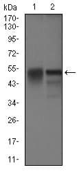 Monoclonal Mouse anti-Human DCTN4 / Dynactin 4 Antibody (clone 3G9D7, aa57-298, IHC, IF, WB)