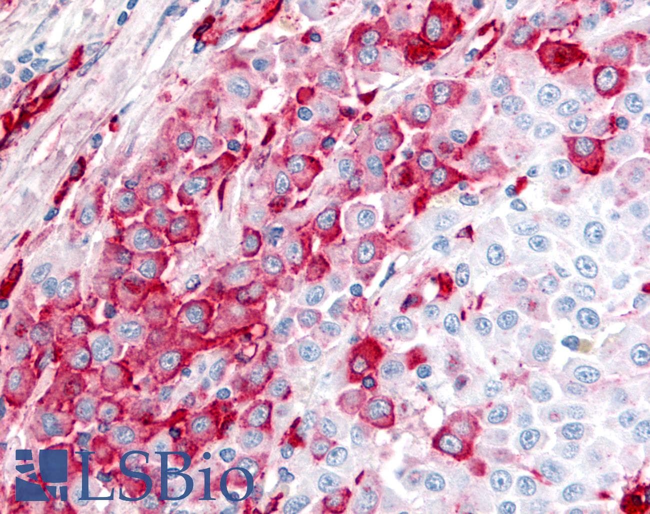 IHC-plus™ BEST4 Antibody (Internal)