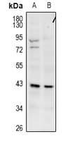 GPR173 / SREB3 Antibody