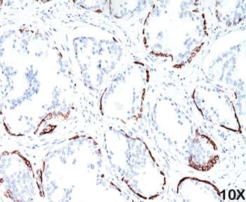 Keratin, HMW Antibody (clone 34BE12)