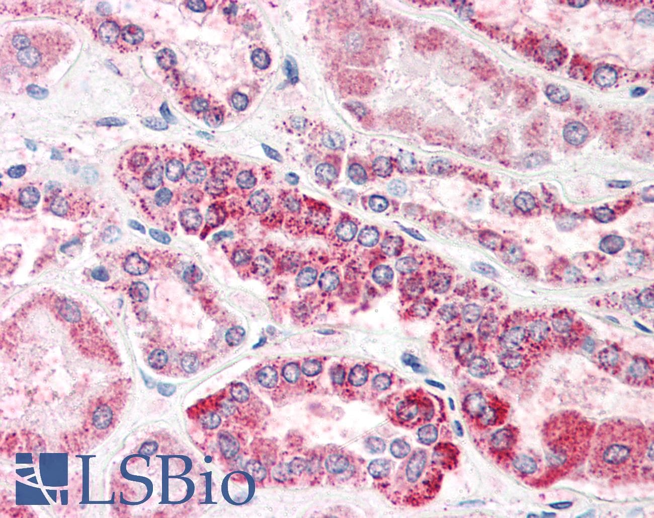 IHC-plus™ CED6 / GULP1 Antibody (aa291-304)