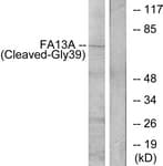 F13A1 / Factor XIIIa Antibody (aa20-69)