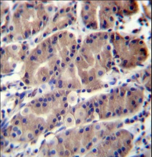 RMA1 / RNF5 Antibody (aa65-94)