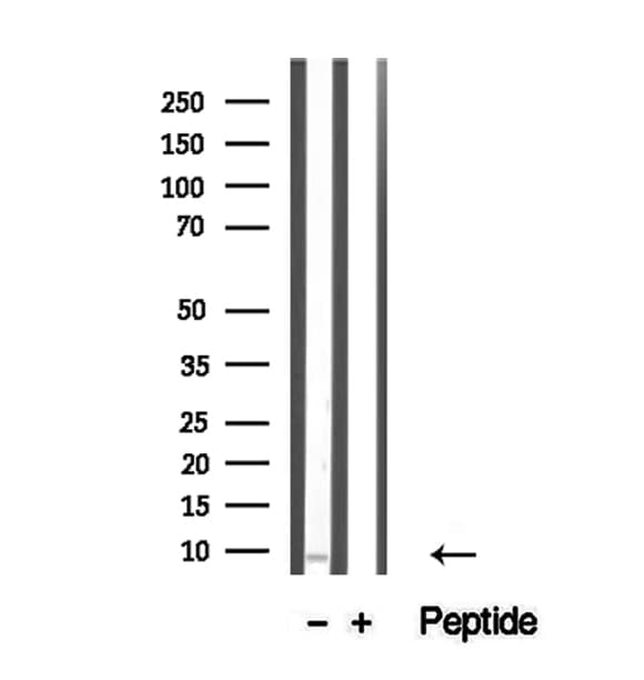 TNP1 / TP1 Antibody