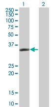 Monoclonal Mouse anti-Human LASP1 Antibody (clone 4F5, WB)
