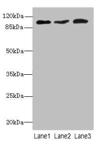 DDX20 / GEMIN3 Antibody