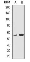 TS / Thromboxane Synthase Antibody