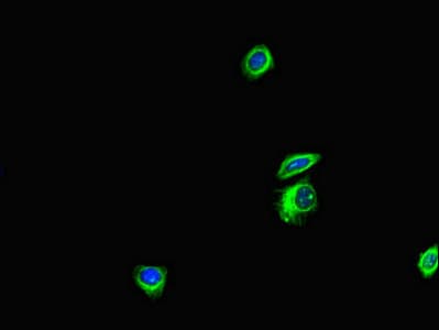 Polyclonal Rabbit anti-Human ANKS6 Antibody (IHC, IF)
