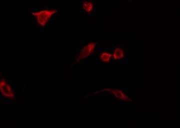 N4BP2L2 Antibody