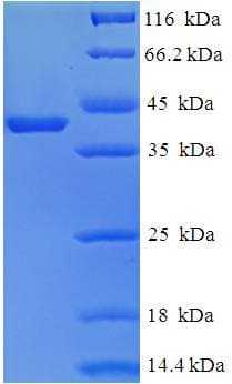 Human TESC Protein (Recombinant His-SUMO)